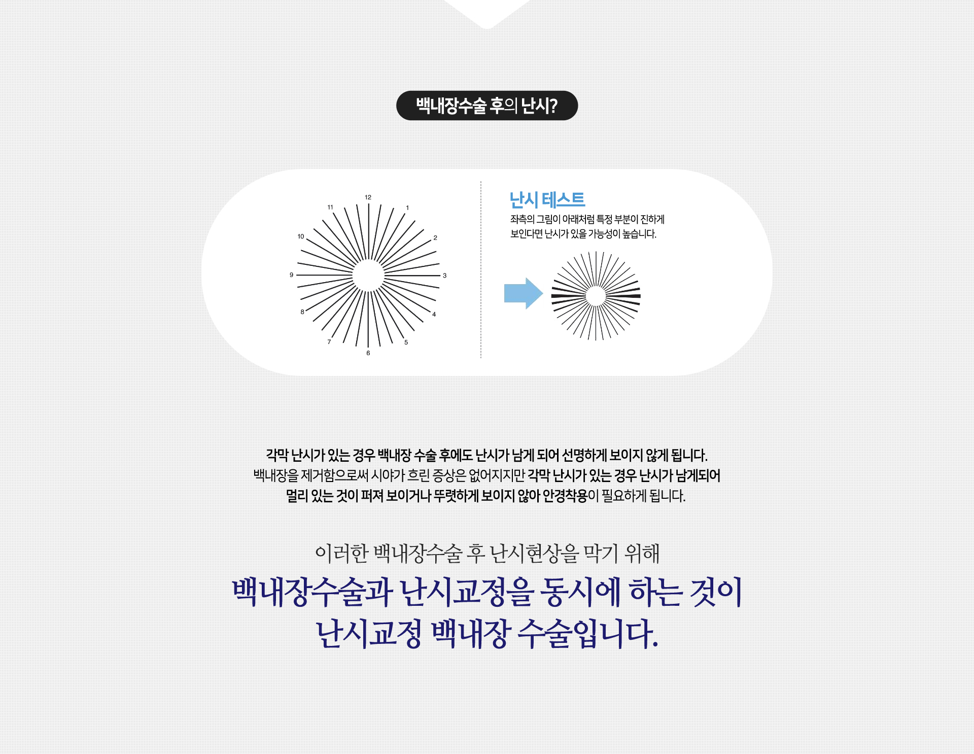 난시교정백내장수술