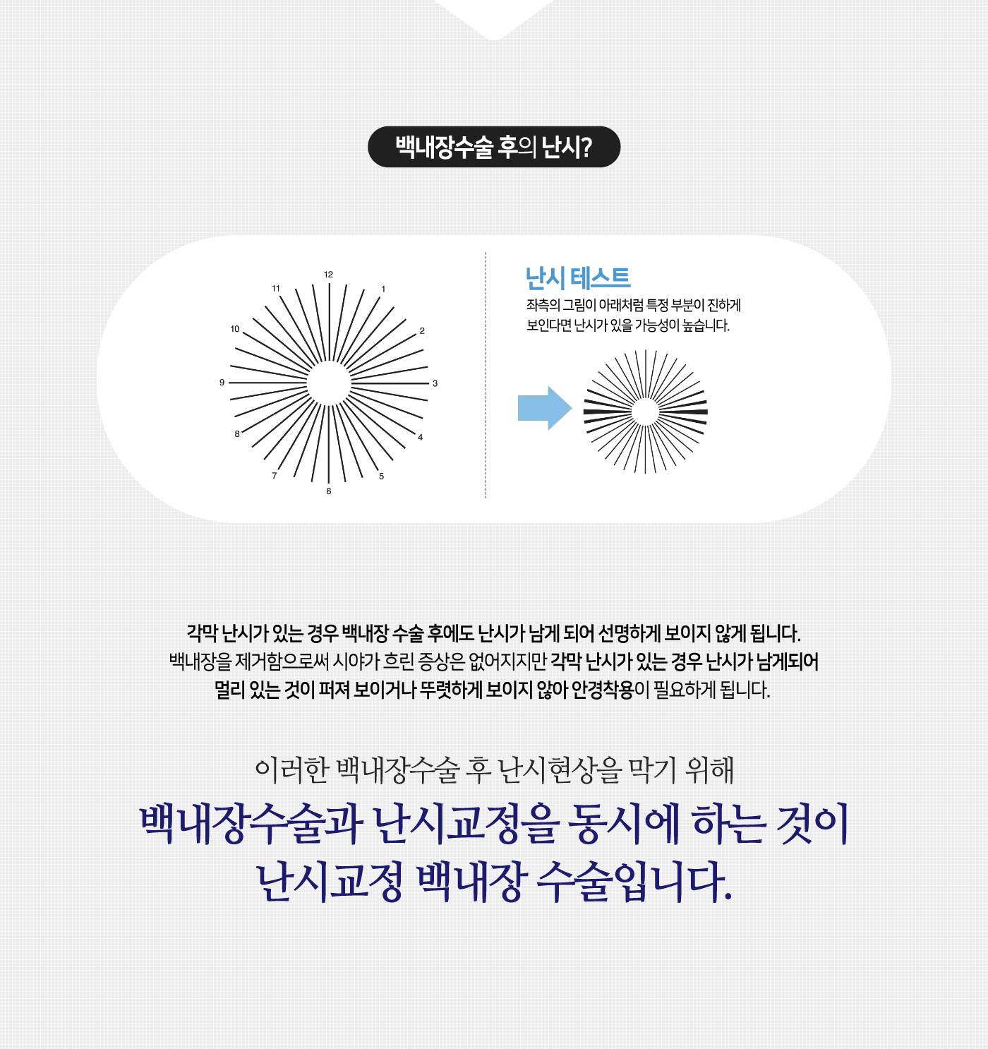 난시교정백내장수술