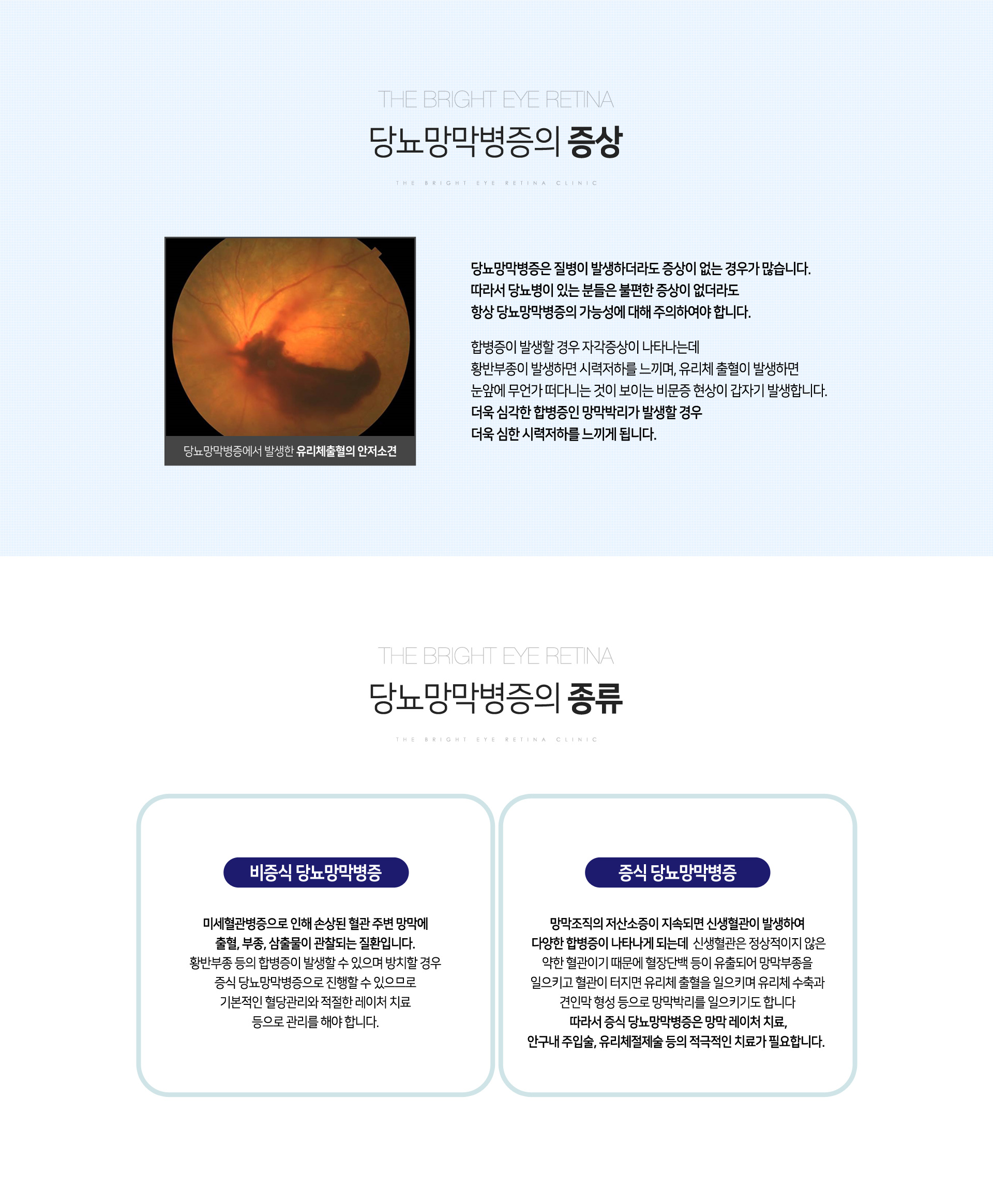 당뇨망막병증