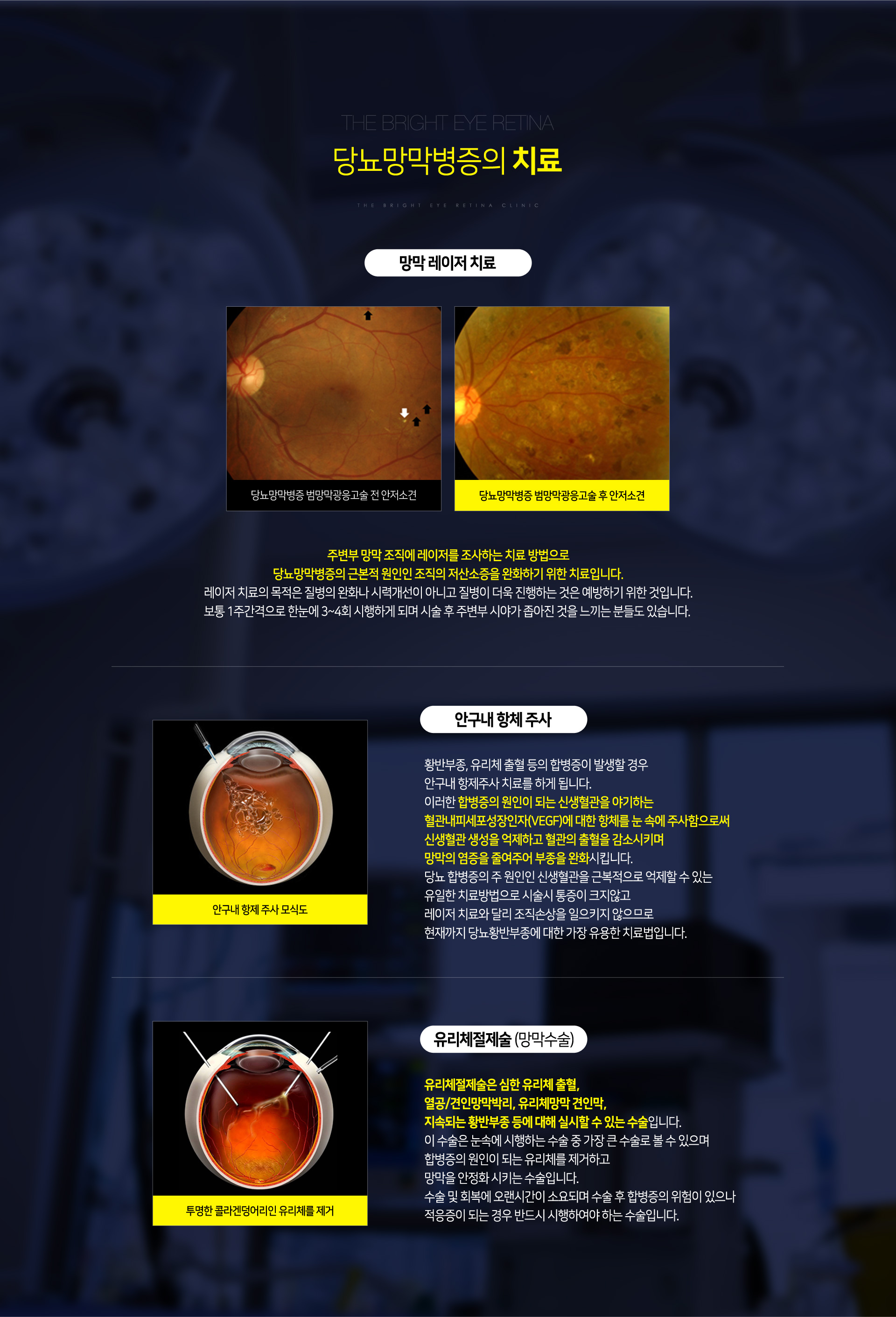 당뇨망막병증