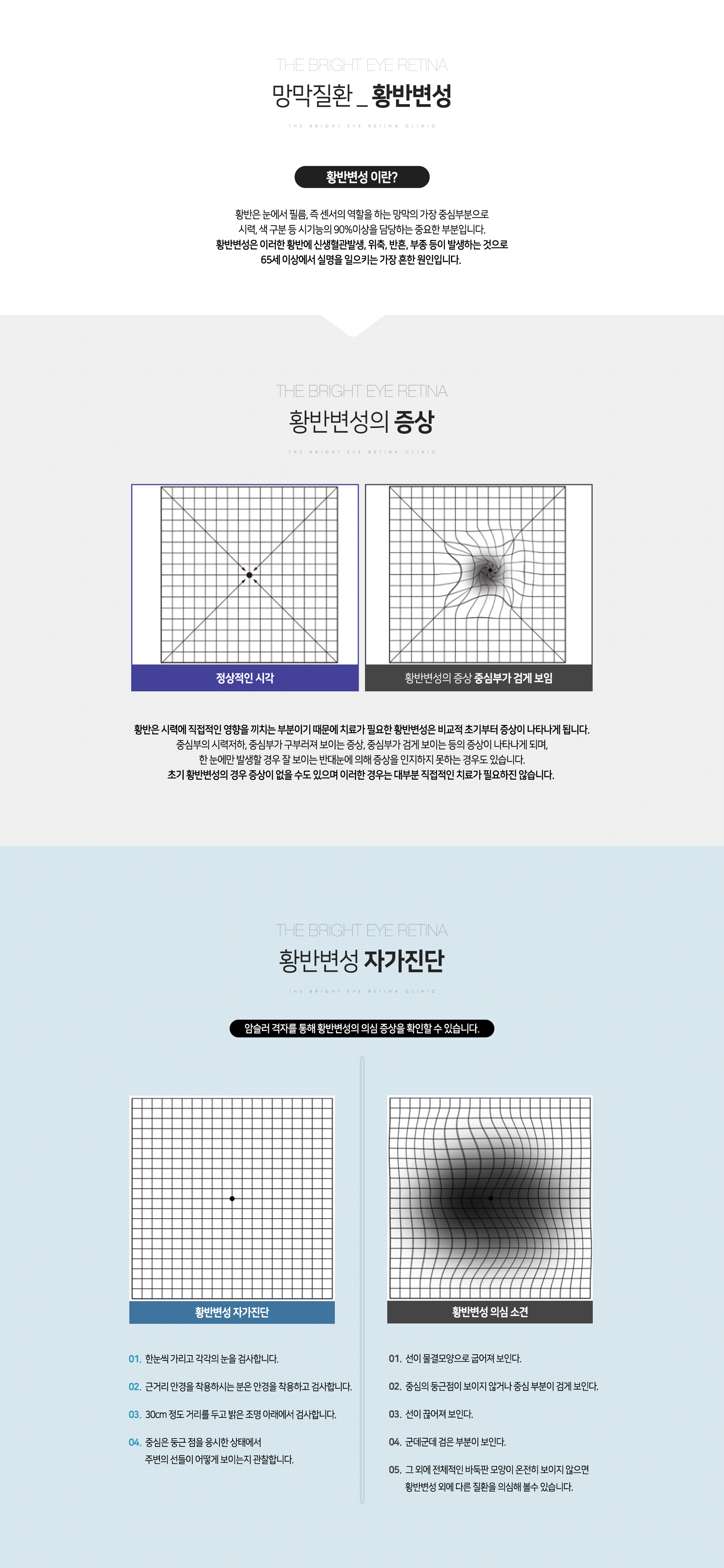 황반변성
