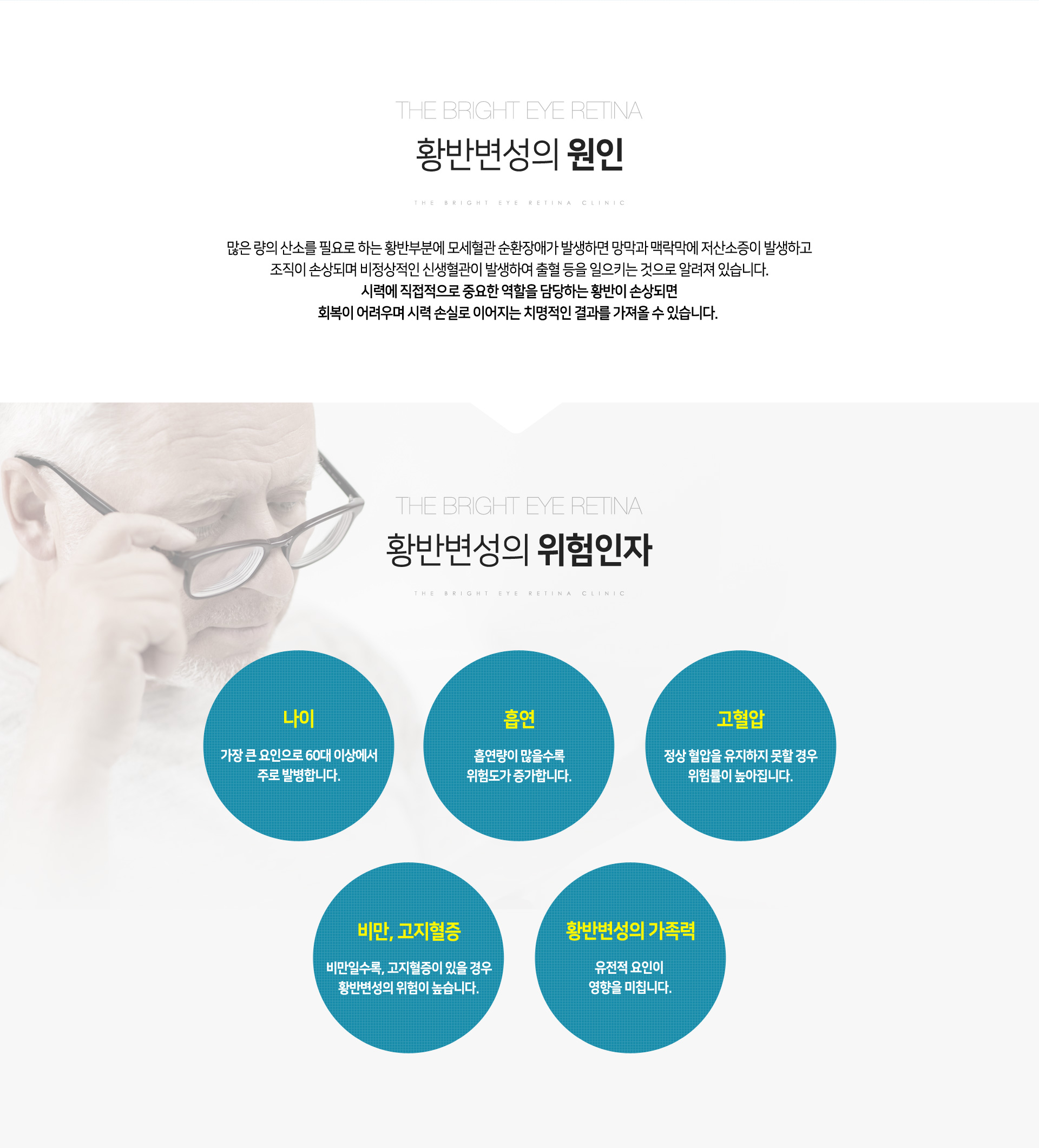 황반변성