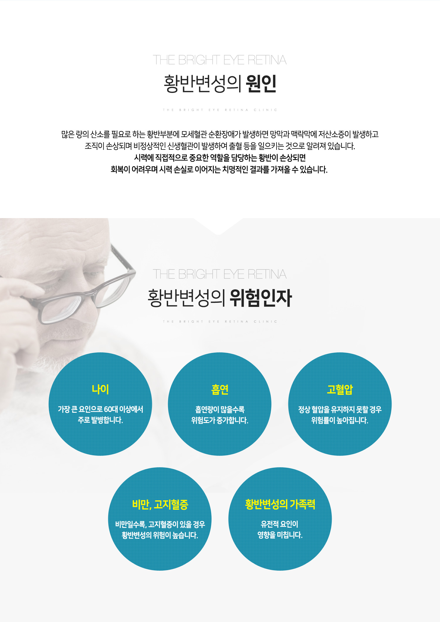 황반변성