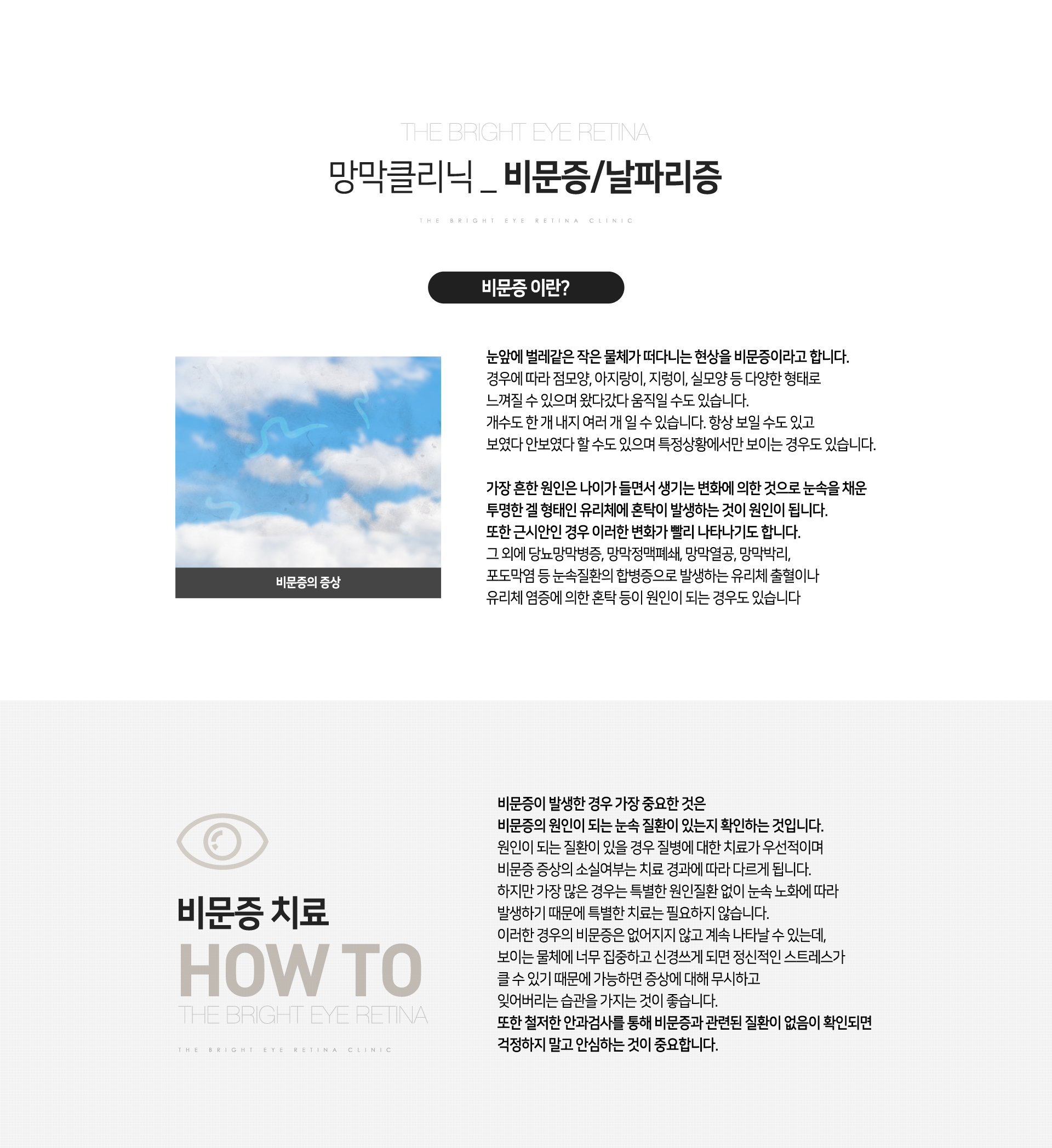 비문증/날파리증