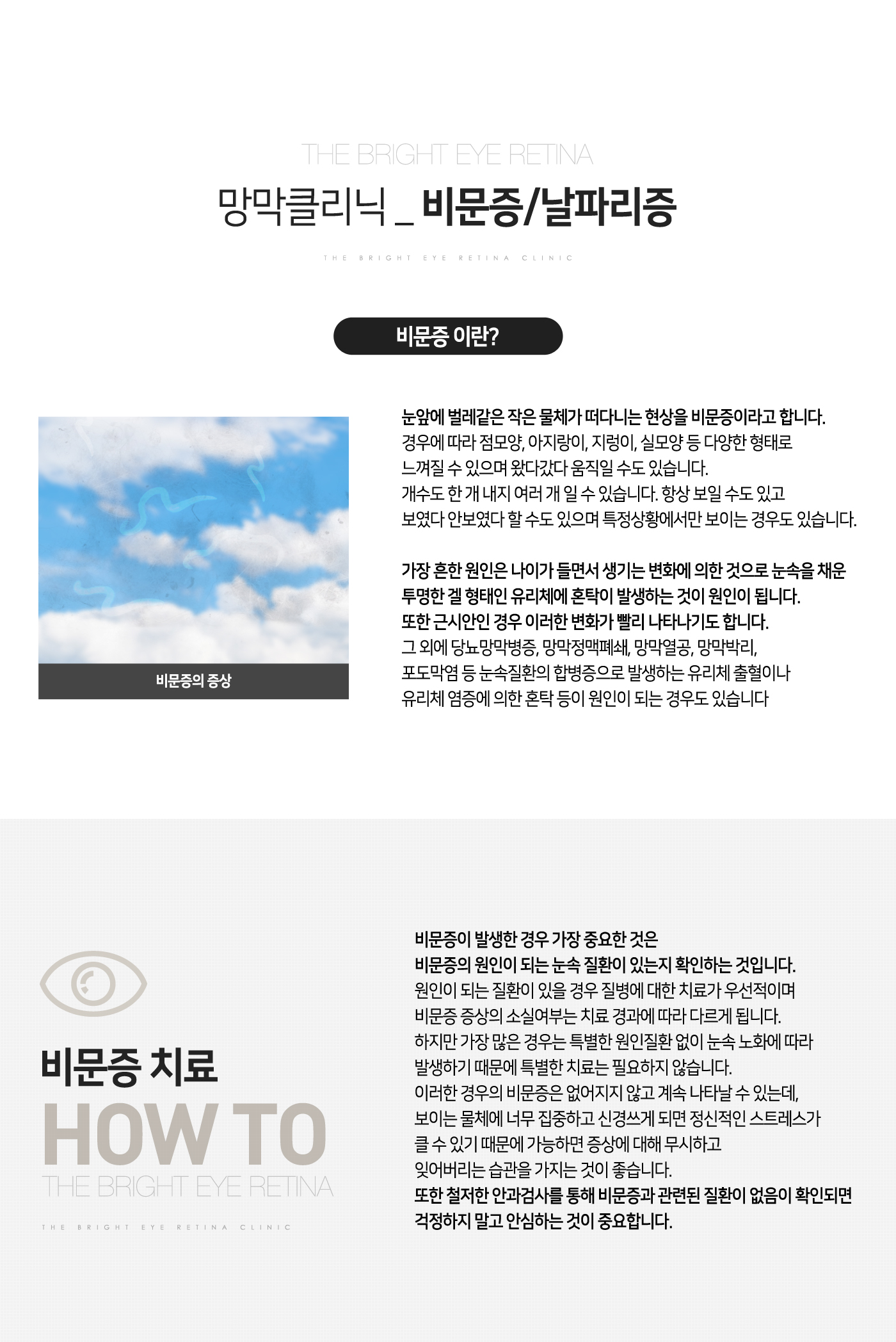 비문증/날파리증