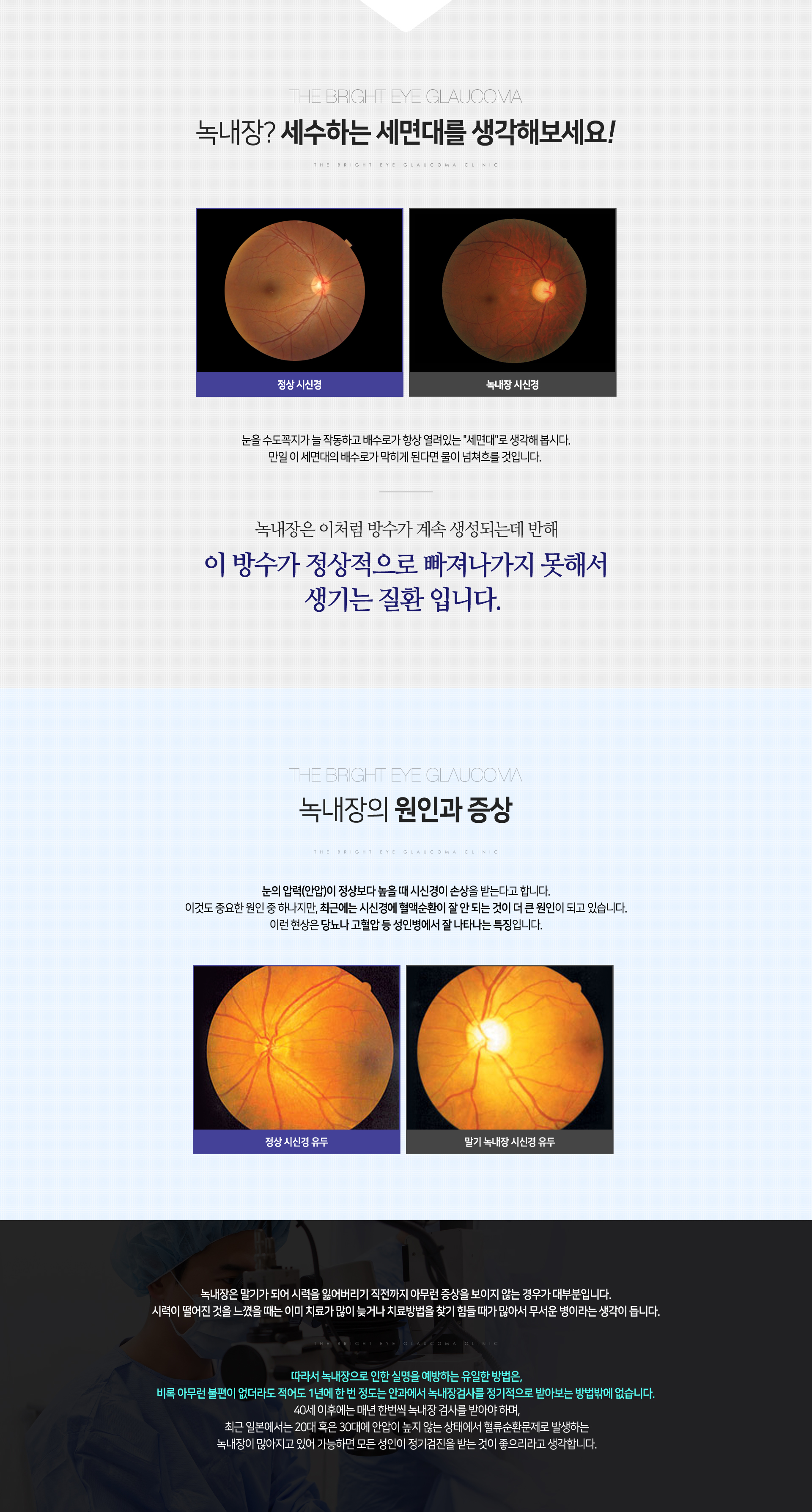 녹내장