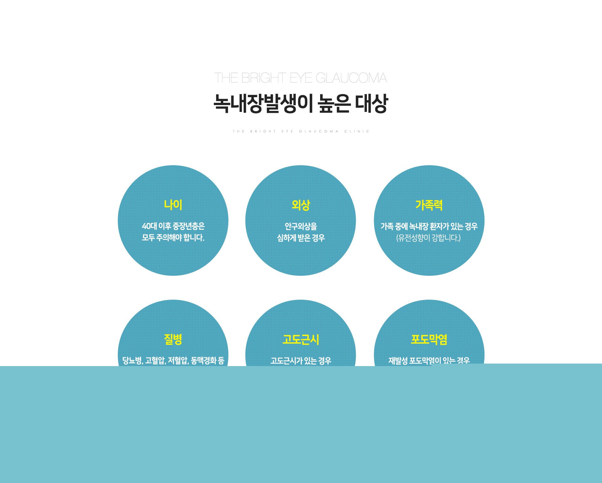 녹내장