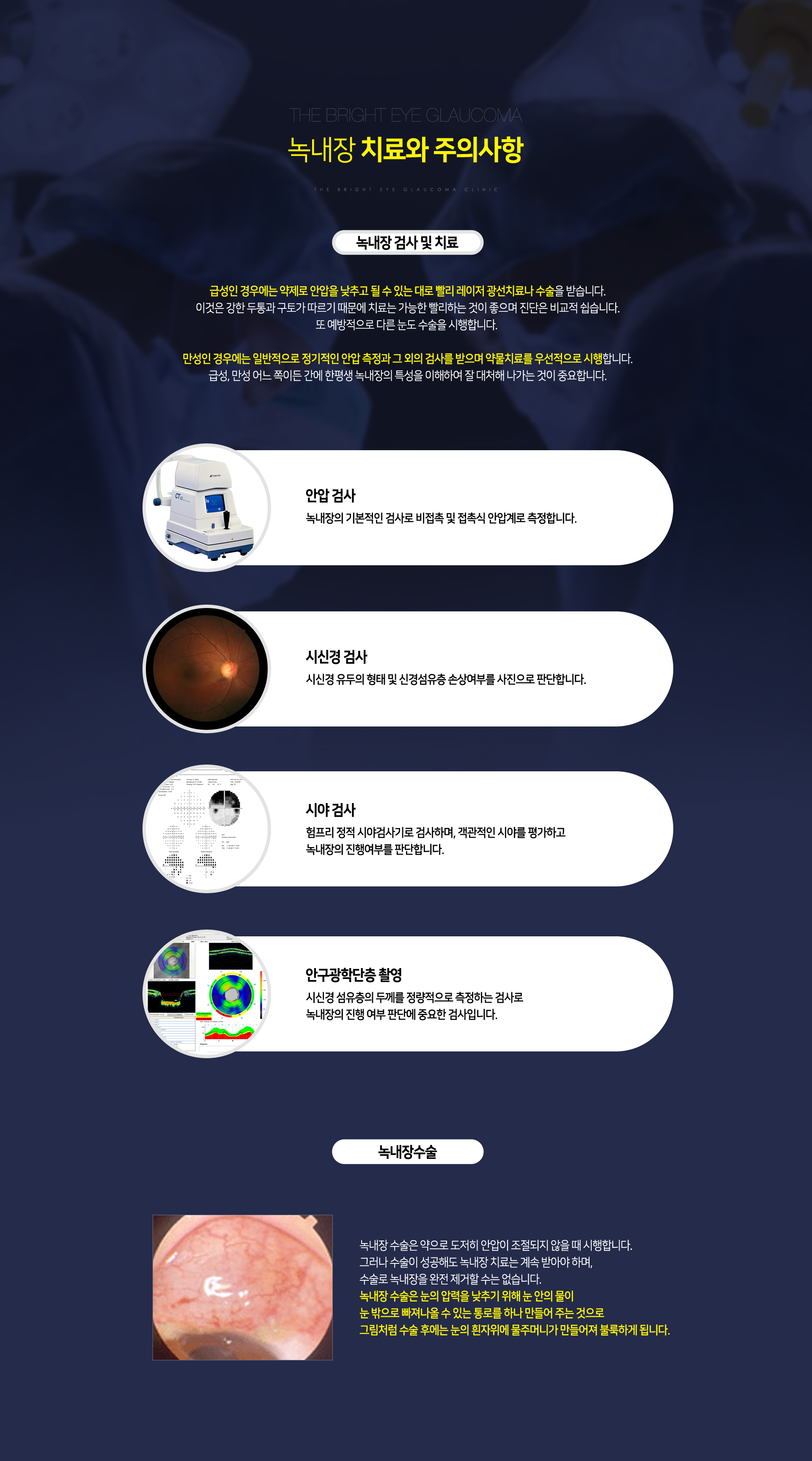 녹내장