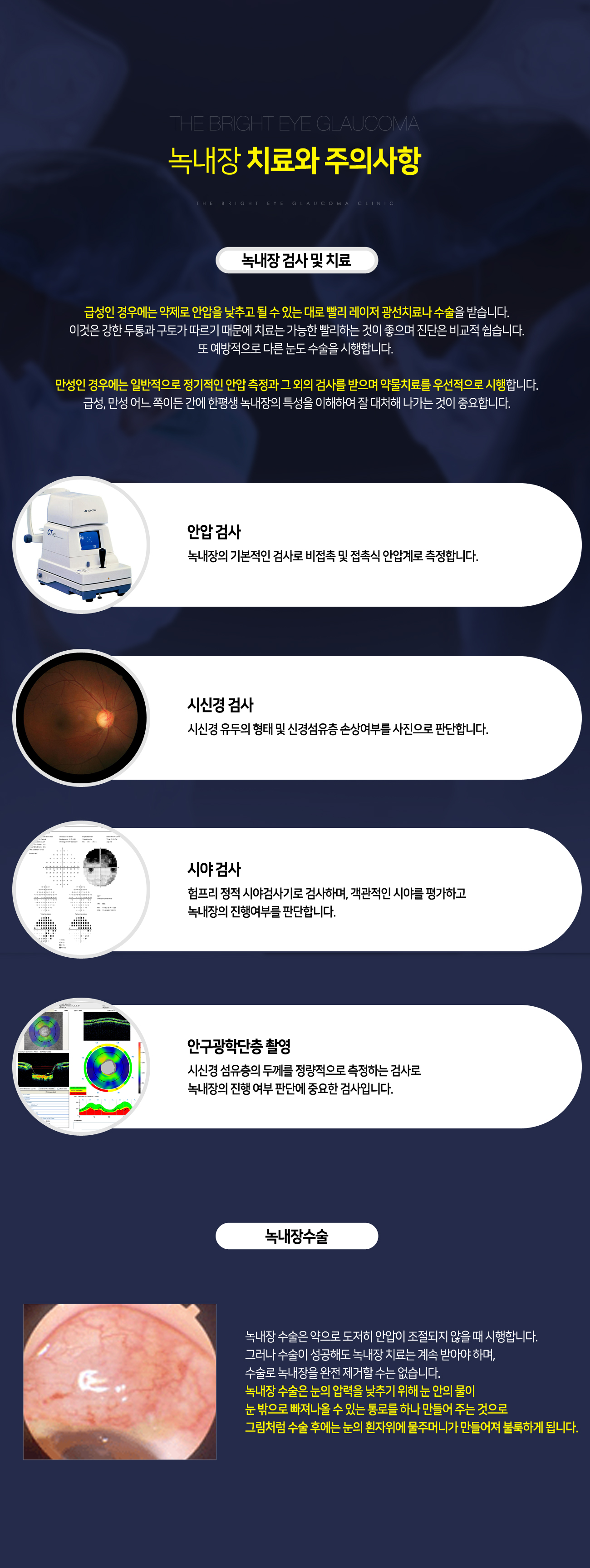 녹내장