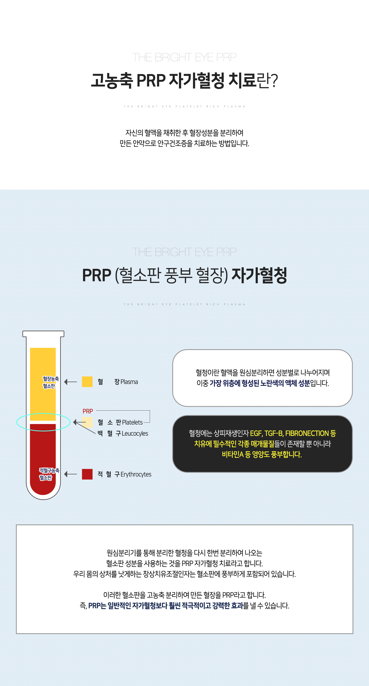 자가혈청치료