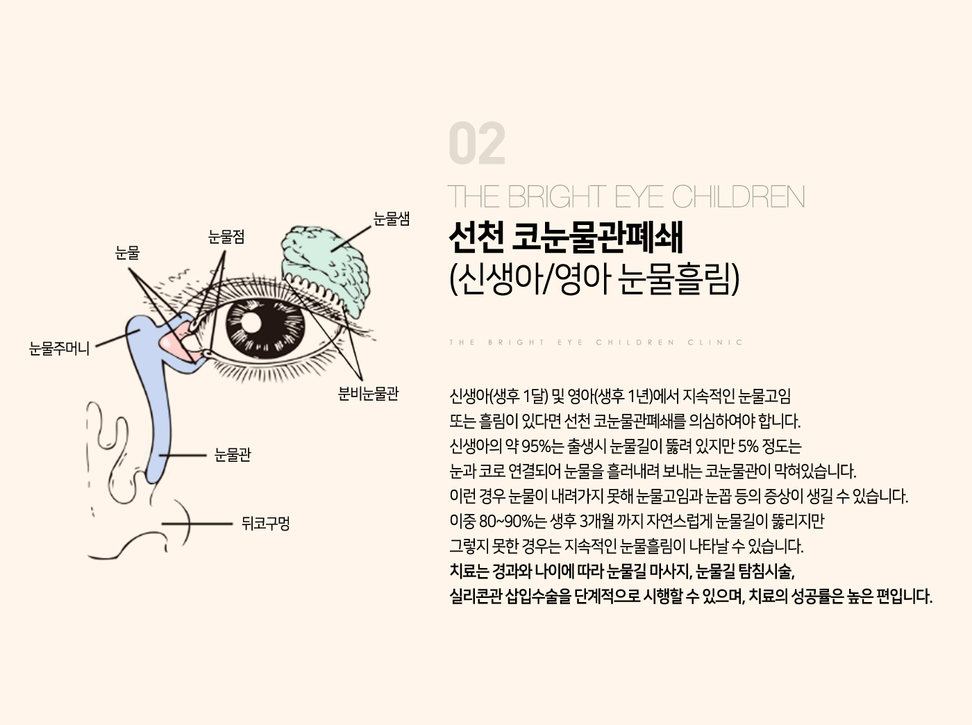 눈물흘림